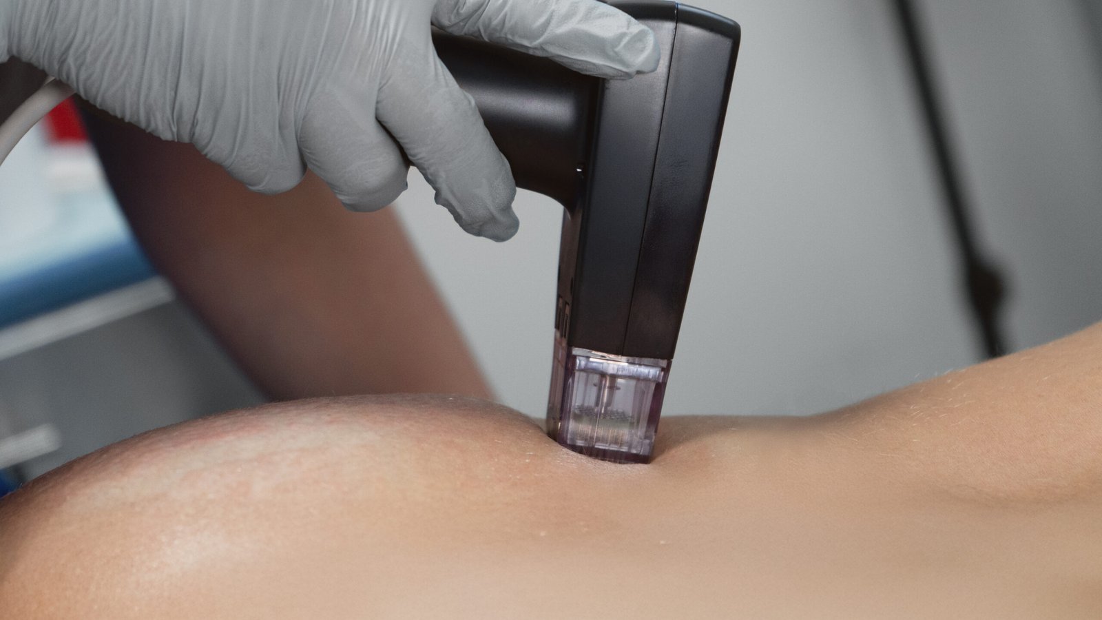 SKINGROUP_SERVICIOS_ADVANCED Skingroup | Dermatólogos en Monterrey