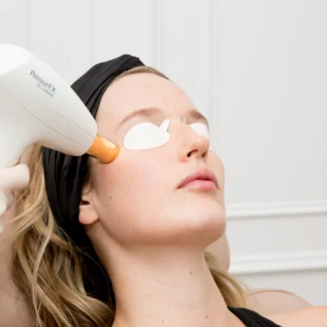 Resurfix-Women-2 Skingroup | Dermatólogos en Monterrey