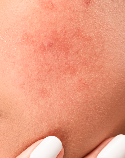 Skingroup | Dermatólogos en Monterrey