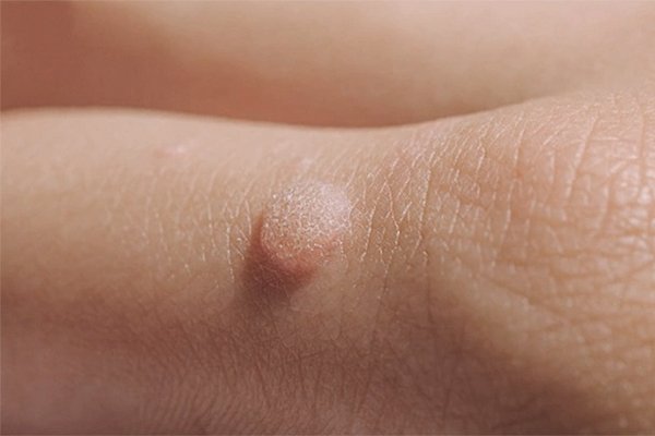 Skingroup | Dermatólogos en Monterrey