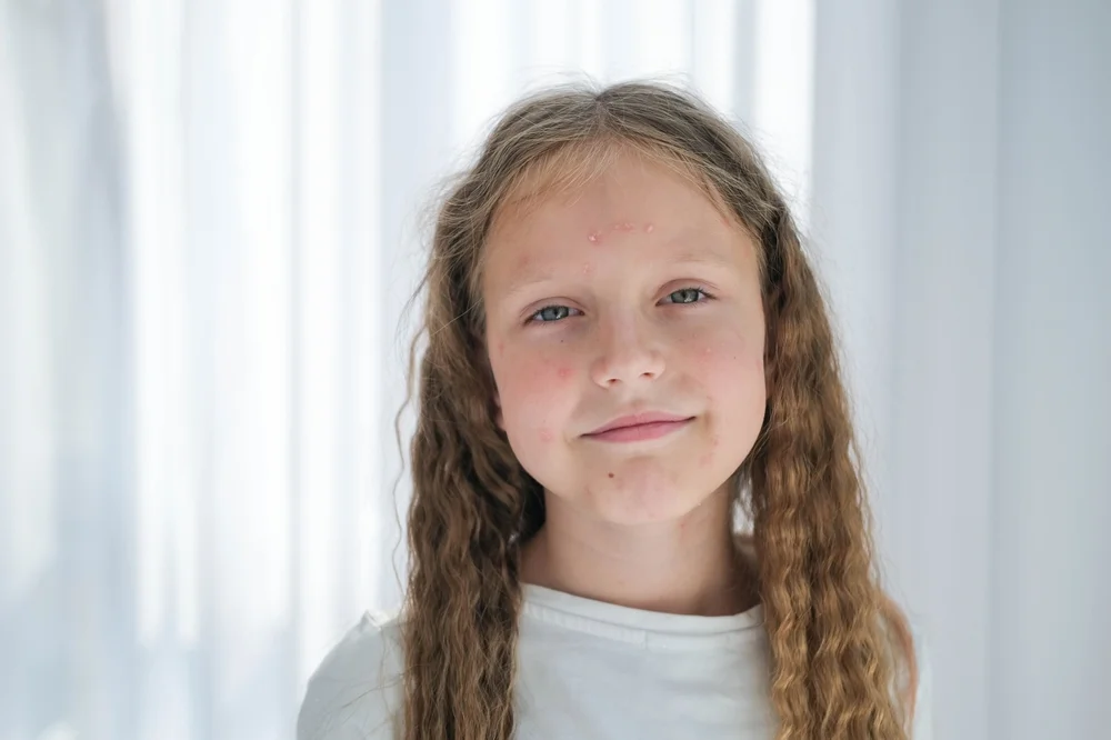 Skingroup | Dermatólogos en Monterrey