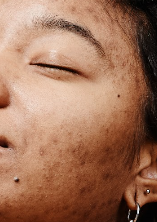 Skingroup | Dermatólogos en Monterrey