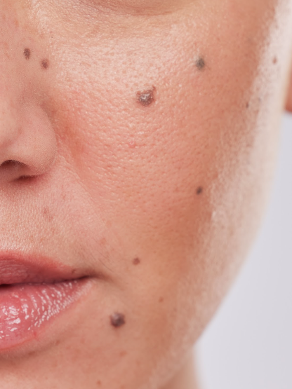 Skingroup | Dermatólogos en Monterrey