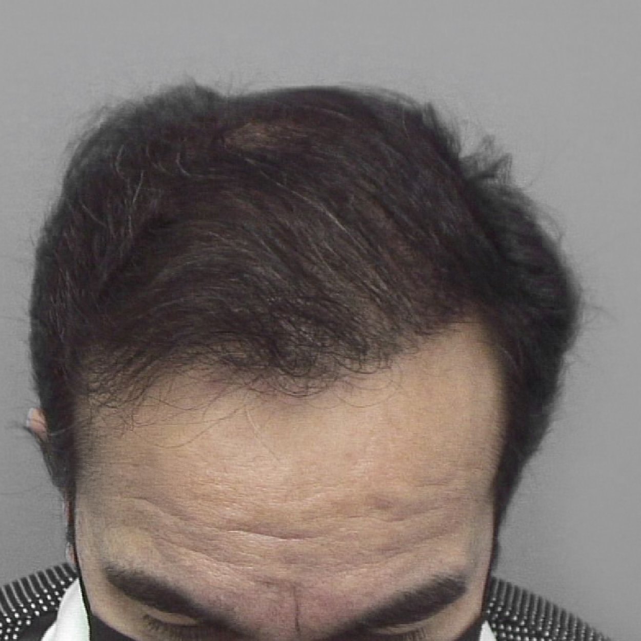 Skingroup | Dermatólogos en Monterrey