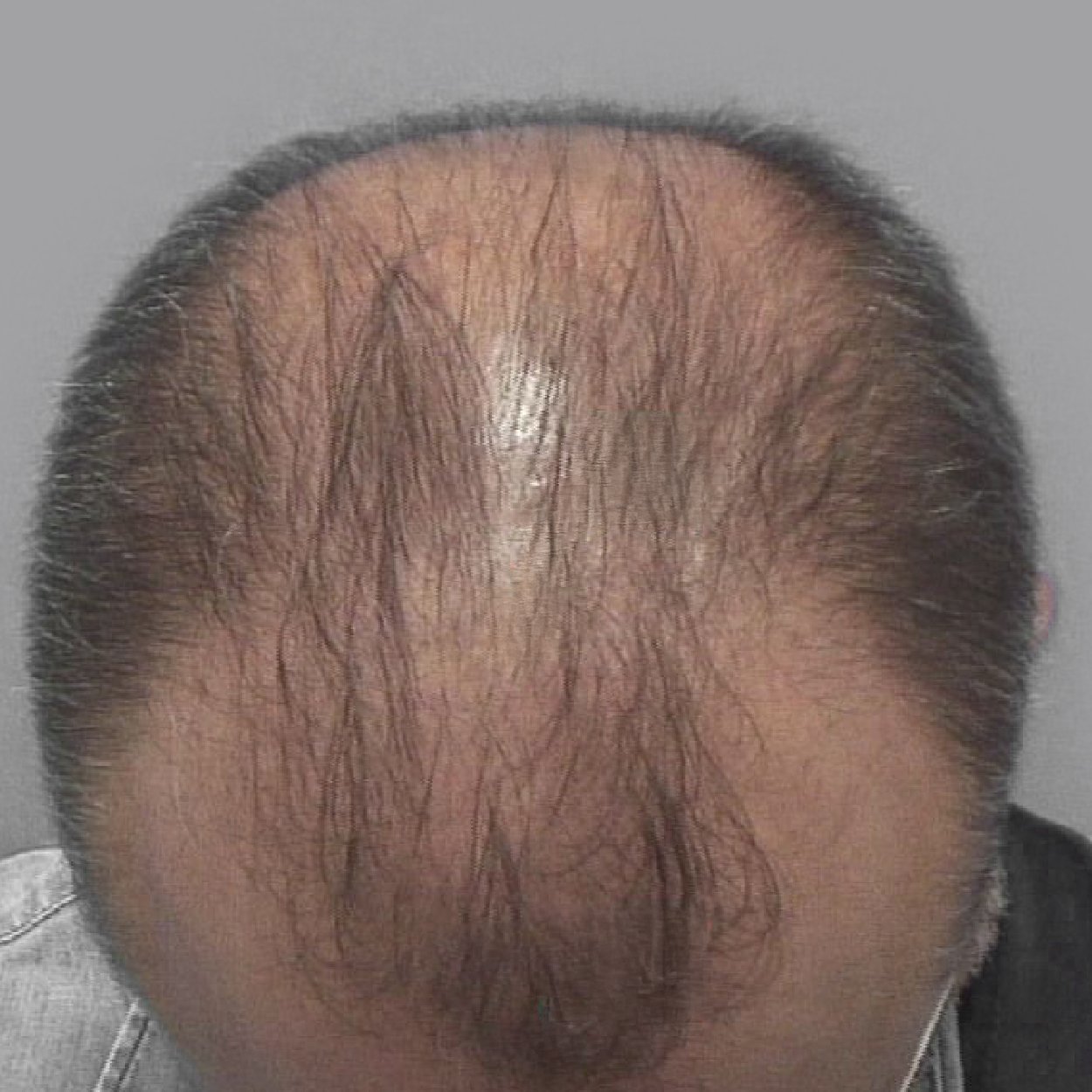 Skingroup | Dermatólogos en Monterrey