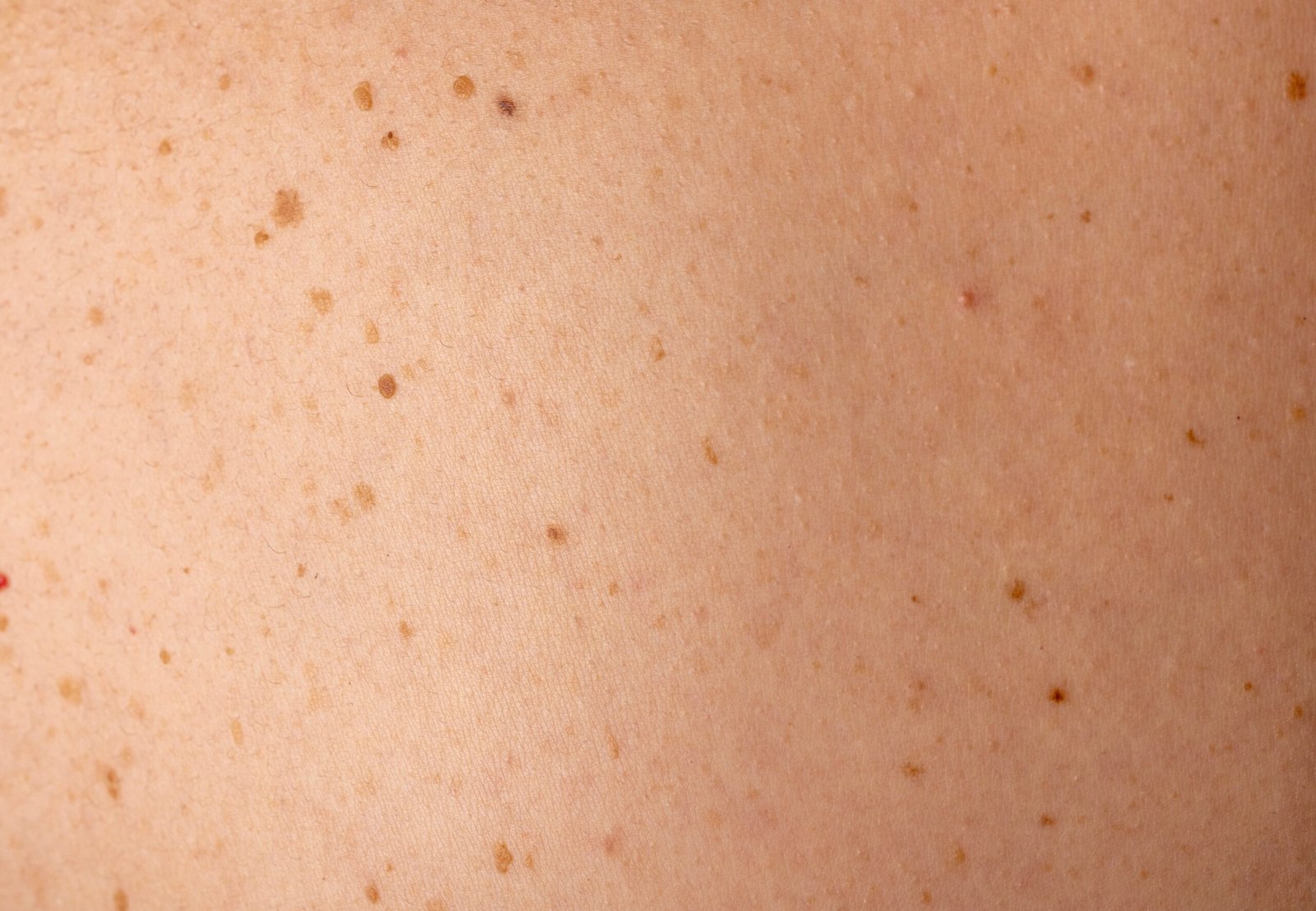 Skingroup | Dermatólogos en Monterrey