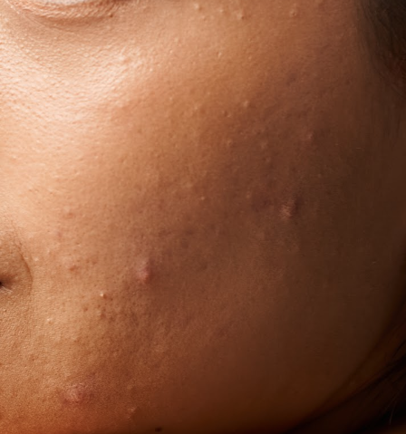 Skingroup | Dermatólogos en Monterrey