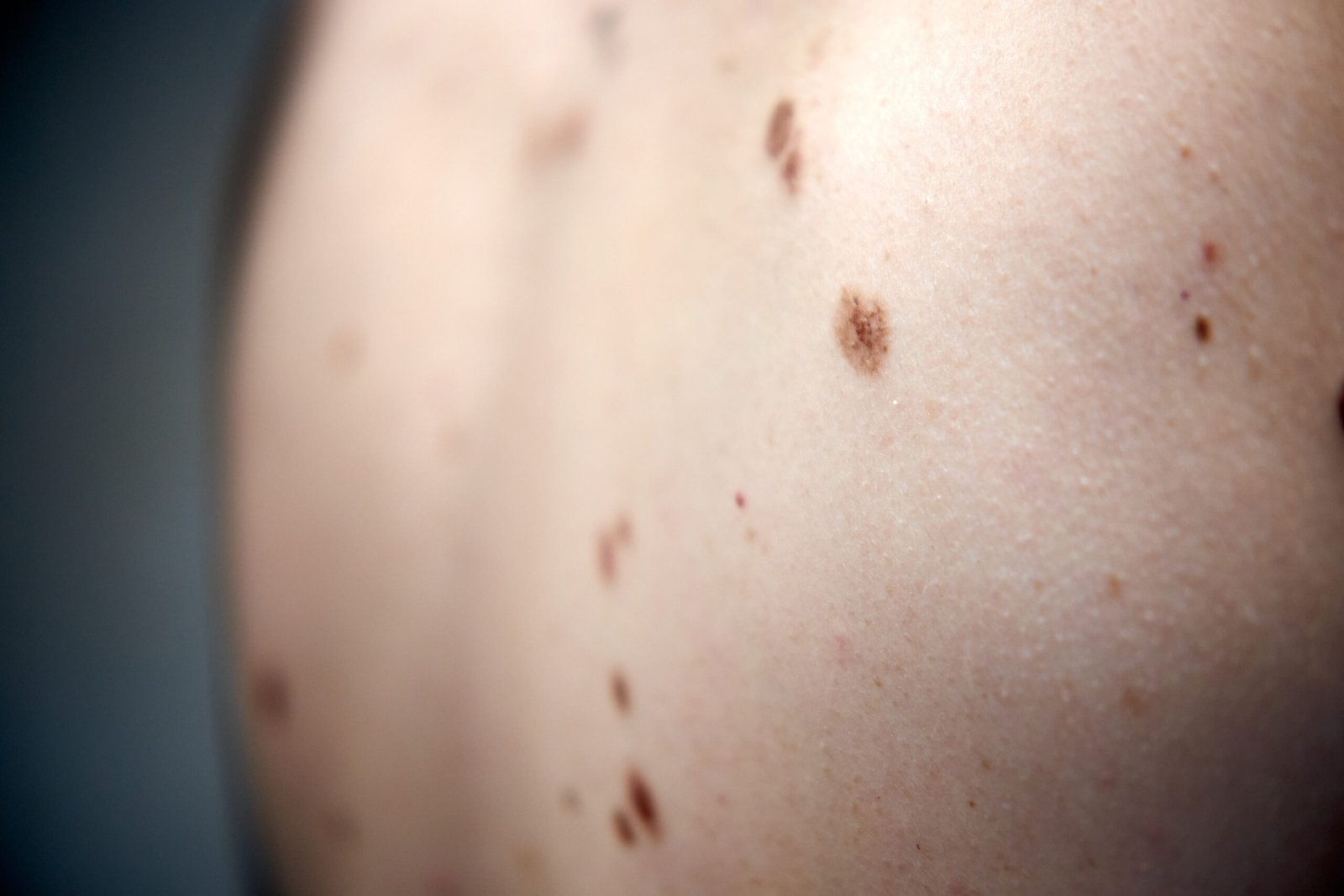 Skingroup | Dermatólogos en Monterrey