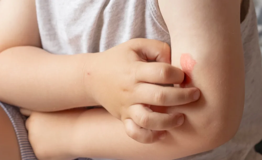 Skingroup | Dermatólogos en Monterrey