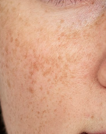 Skingroup | Dermatólogos en Monterrey