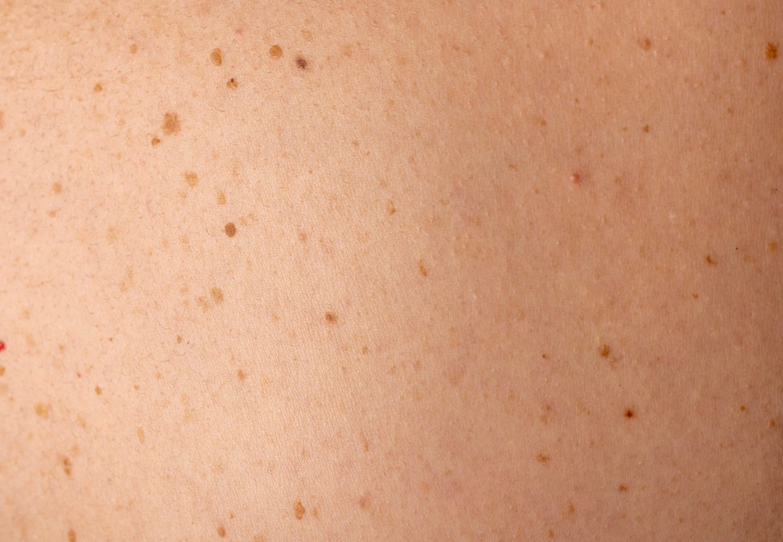 Skingroup | Dermatólogos en Monterrey