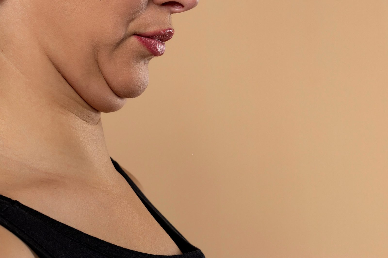 Young,Woman,With,Double,Chin,On,Beige,Studio,Background,,Closeup. Skingroup | Dermatólogos en Monterrey