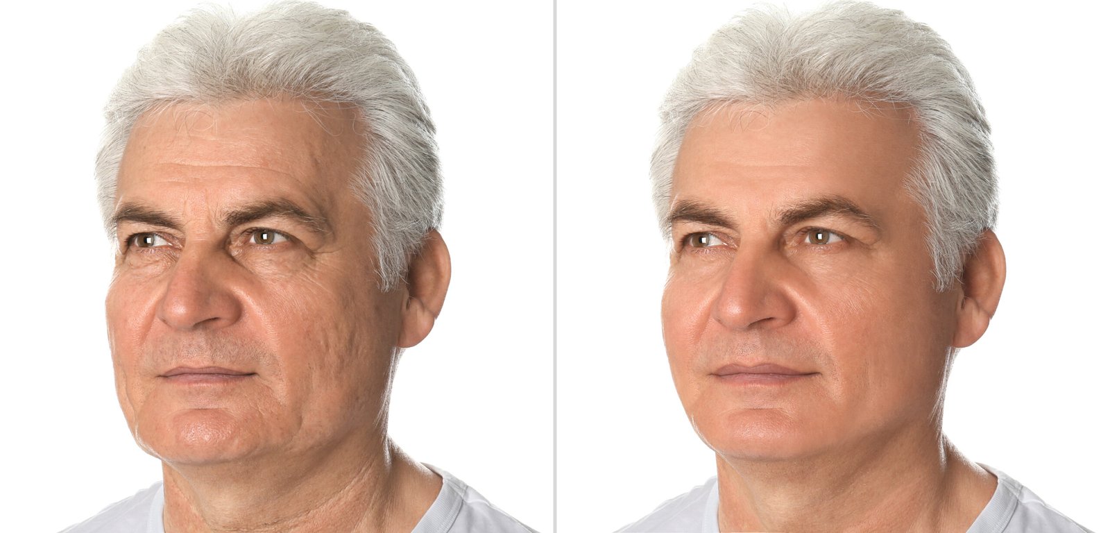 Mature,Man,Before,And,After,Plastic,Surgery,On,White,Background