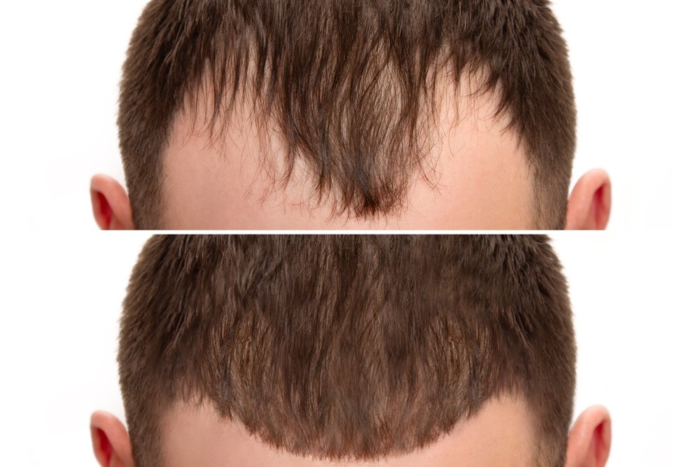 Cropped,Before,And,After,Head,Shot,Of,A,Young,Male