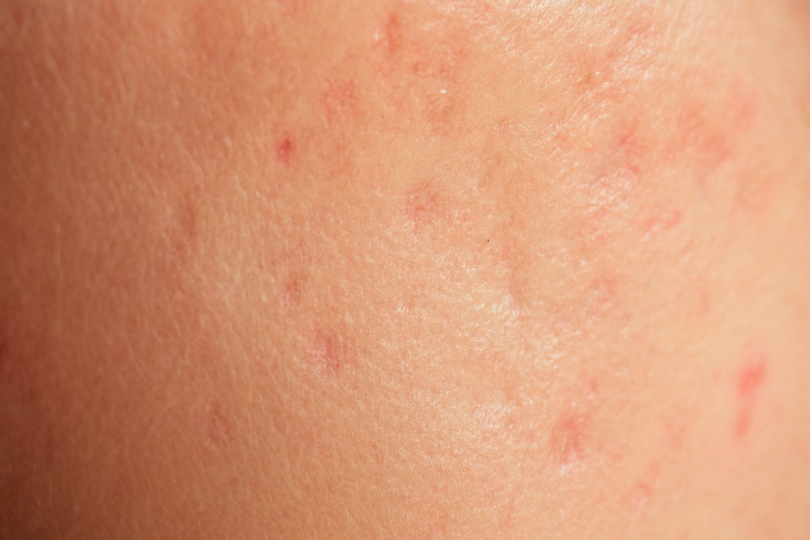 Skingroup | Dermatólogos en Monterrey
