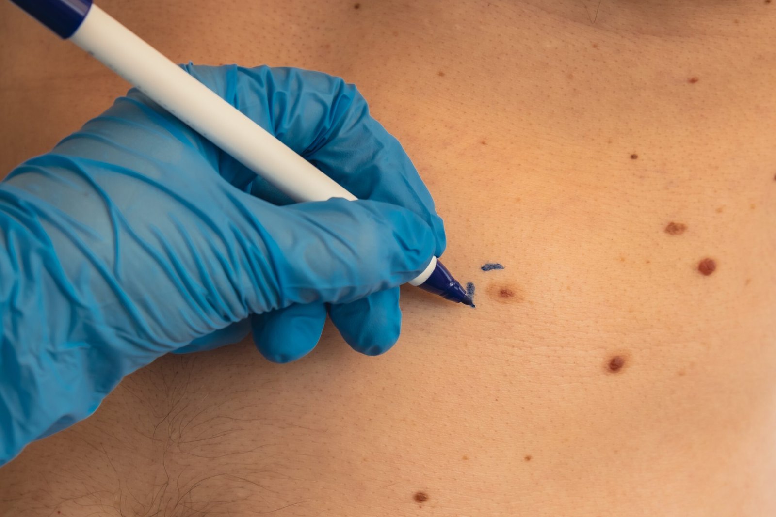 Skingroup | Dermatólogos en Monterrey
