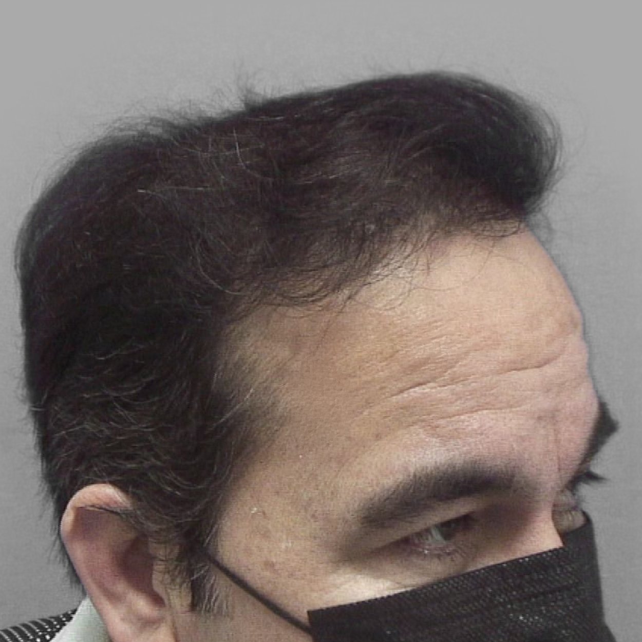 Skingroup | Dermatólogos en Monterrey